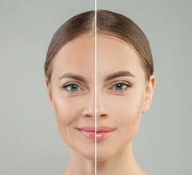 AgeRewind Radiance Facial