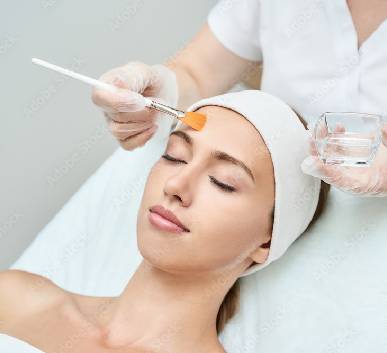 Chemical Peels
