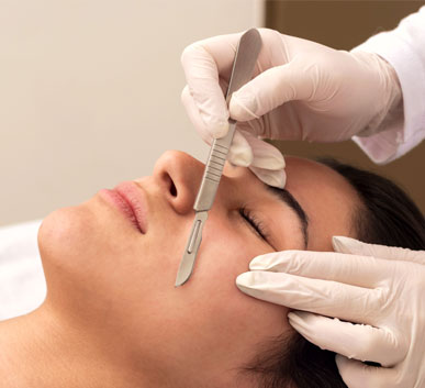 Dermaplaning