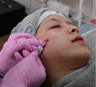 Clarifying Acne Rescue